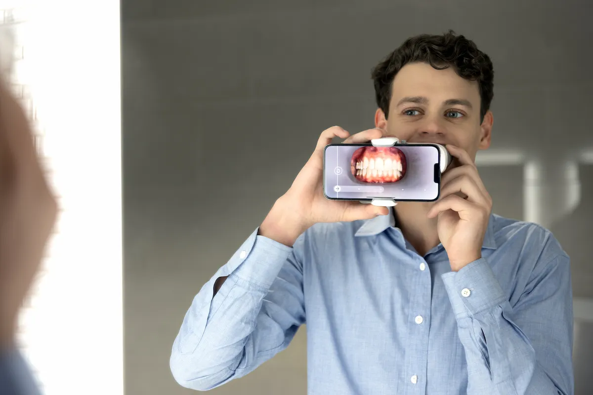 Animated smile during CandidPro Clear Aligner tray placement