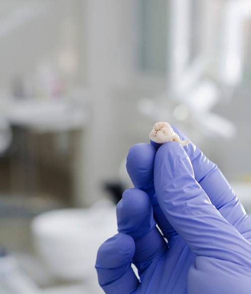 Gloved hand holding up an extracted wisdom tooth